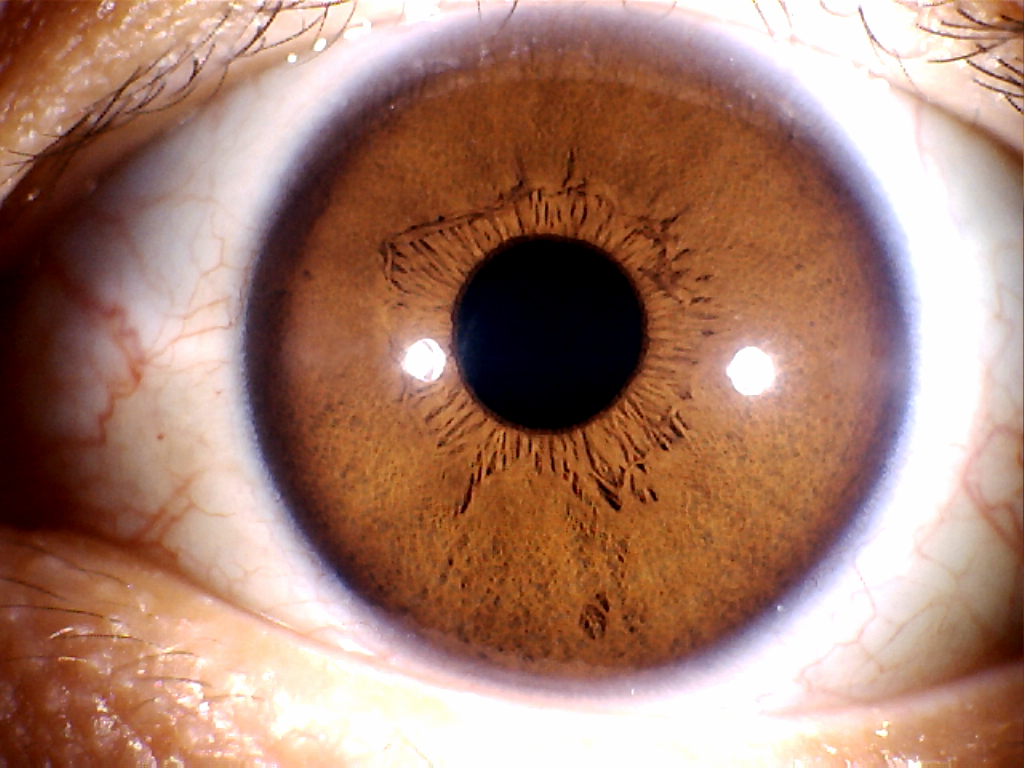 全新500万像素usb电脑型左/右灯自动分析虹膜检测仪