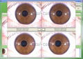 全新500万像素USB电脑型左/右灯自动分析虹膜检测仪