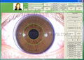 NEW 5M Pixels High Resolution USB Eye Iriscope,Iridology camera(EH-990U)