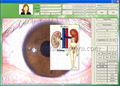 NEW 5M Pixels High Resolution USB Eye Iriscope,Iridology camera(EH-990U)