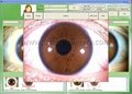 NEW 5M Pixels High Resolution USB Eye Iriscope,Iridology camera(EH-990U) 12