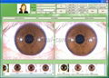 全新500萬像素USB電腦型自動分析虹膜儀,虹膜檢測儀