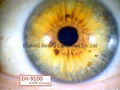 NEW 8.0MP Iriscope / Eye Iriscope Iridology camera / Iriscope analyzer equipment 5