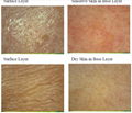 NEW 8.0MP UV skin analyzer for Skin Mositure, Grease, Wrinkle, Pigmentatio 2