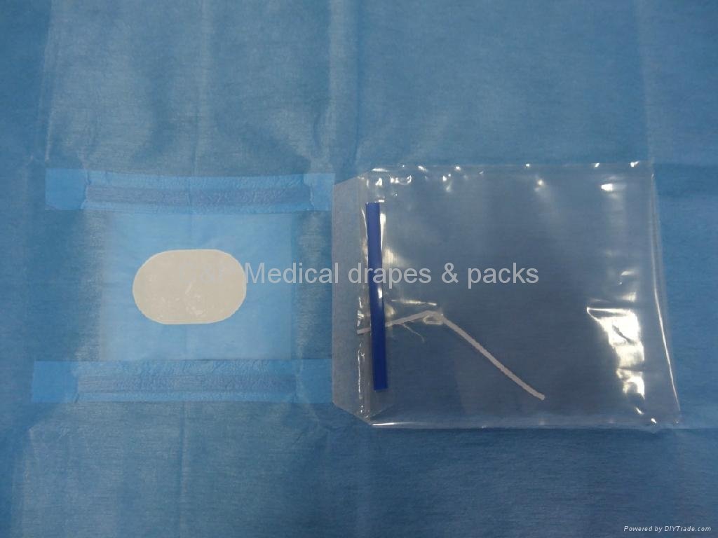  Ophthalmic drape with 1 fluid collectiion pouch 4