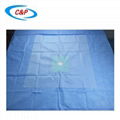 Customized Impermeable Extremity Surgical Drape