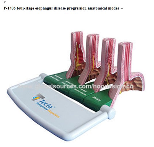 P-1406  Four-stage esophagus disease progression anatomical modes