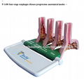 P-1406  Four-stage esophagus disease progression anatomical modes 1