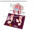 F-194Two-stage bronchial and lung's alveoli model with printed instruction card 