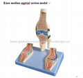 P-1287 Knee median sagittal section model  1