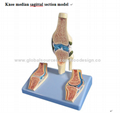 P-1287 Knee median sagittal section model 