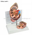 P-1122 Kidney model 