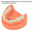 P-1347 Teaching Denture Tooth Model  1