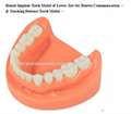 P-1347 Teaching Denture Tooth Model 