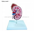 P-1166 Kidney model