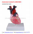 P-1120 Anatomical heart model