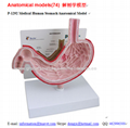 P-1292 Medical Human Stomach Anatomical