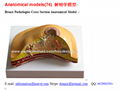 P-1364 Breast Pathologies Cross Section Anatomical Model  1