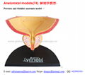 P-1312 Prostate and bladder anatomic