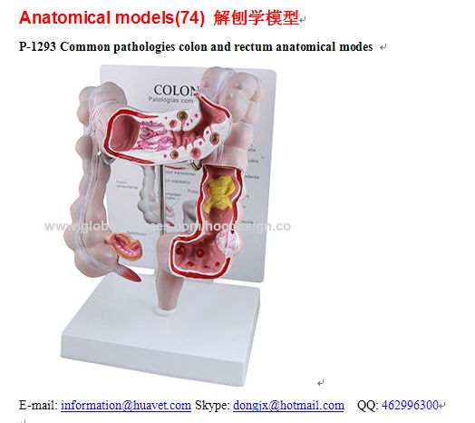 P-1293 Common pathologies colon and rectum anatomical modes 
