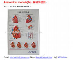 P-1377 3D PVC Medical Poster