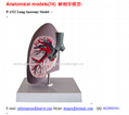 P-1322 Lung Anatomy Model 