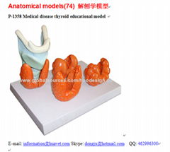 P-1358 Medical disease thyroid educational model