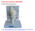 P-1320 Knee Joint Anatomy Model