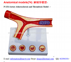 P-1324 Artery Atherosclerosis and Thrombosis Model 