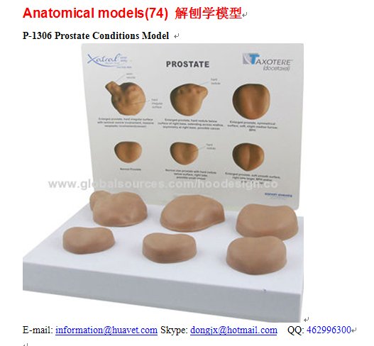 P-1306 Prostate Conditions Model 
