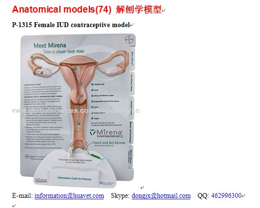 P-1315 Female IUD contraceptive model
