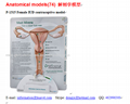 P-1315 Female IUD contraceptive model 1