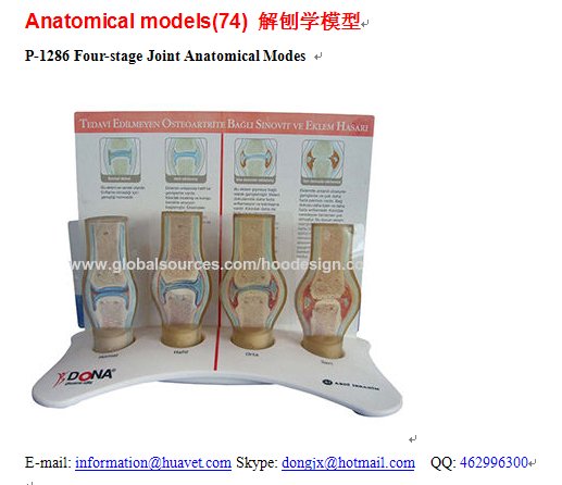 P-1286 Four-stage Joint Anatomical Modes 