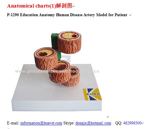 P-1290 Education Anatomy Human Disease Artery Model for Patient 