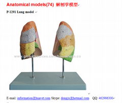 P-1291 Lung model 