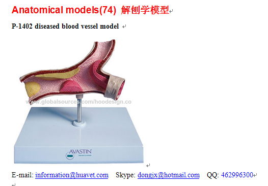 P-1402 diseased blood vessel model 