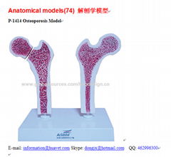 P-1414 Osteoporosis Model