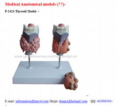 P-1424 Thyroid Model