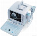 Bestman Ultrasound Scanner BEU-8350T