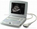 Bestman Ultrasound Scanner BEU-8800 1