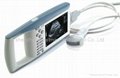 Bestman Ultrasound Scanner BEU-8900