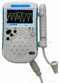 BSM Bestman CE Pocket Vascular Doppler BF-520TFT Home/hopital Use   7