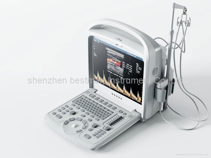 Compact Color Doppler Diagnostic Ultasound System