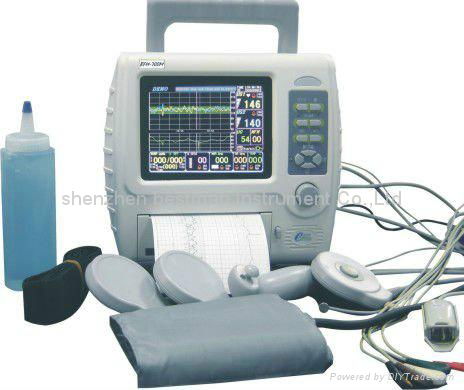 Doppler portable fetal maternal monitor CTG machine fetal heart rate monitor 4