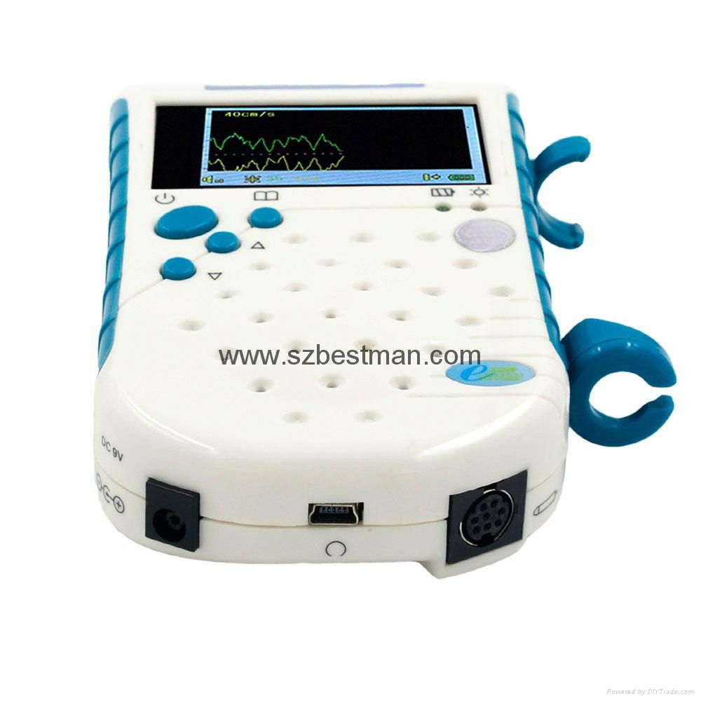 BSM Bestman CE Pocket Vascular Doppler BF-520TFT Home/hopital Use   4