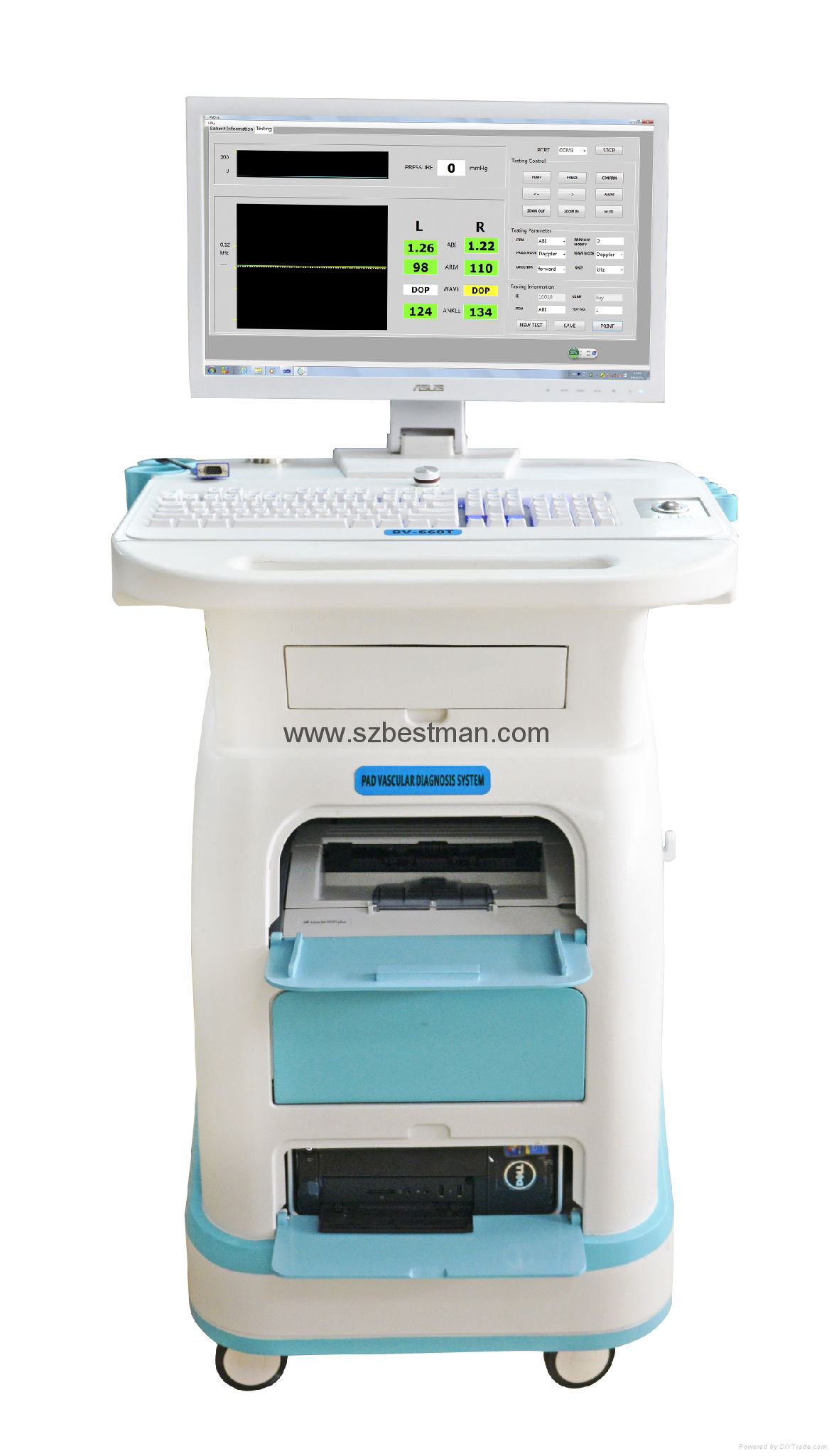 Ultrasound vascular Doppler PAD detector, ABI,TBI, PPG PROBE 2