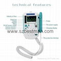 BSM Bestman CE Pocket Vascular Doppler BF-520TFT Home/hopital Use   10