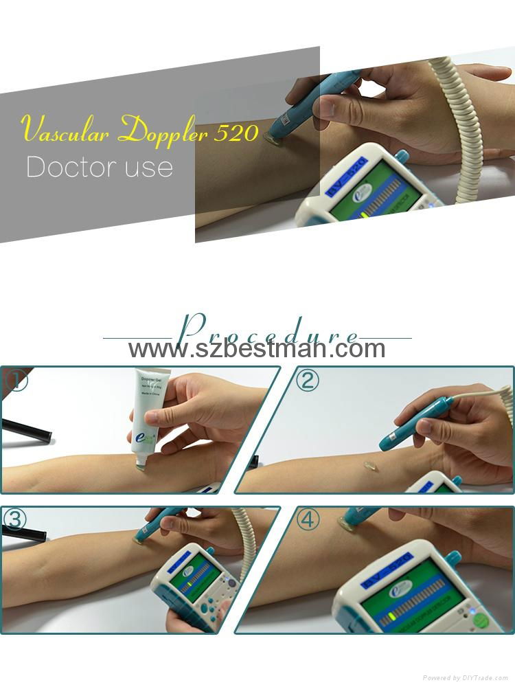 8Mhz Pencil Probe Doppler Vascular Blood Flow Rate Detector Arterial&Vein LED Di 5