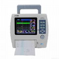 Doppler portable fetal maternal monitor CTG machine fetal heart rate monitor 2