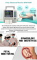 BFM-700M Made in China Fetal Maternal Monitor LCD LED monitor with Twin Doppler